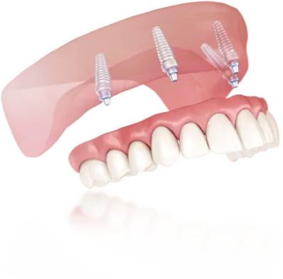 fbf42344aa16e75a5bd1857b52b18445